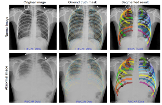 Medical Image Segmentation
